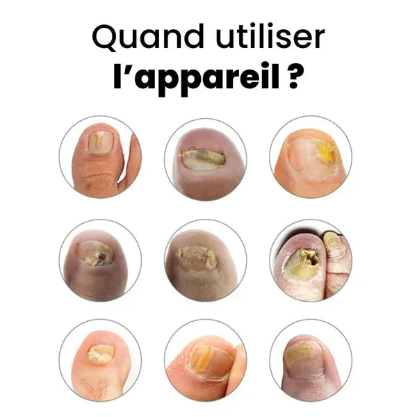 Appareil OrtheoLab