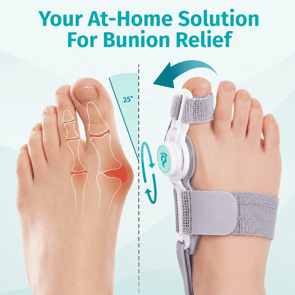 ORTHEO LAB®- BUNION FIX