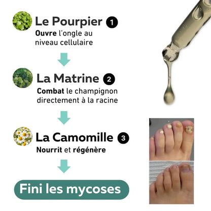Sérum Anti-Mycose OrtheoLab