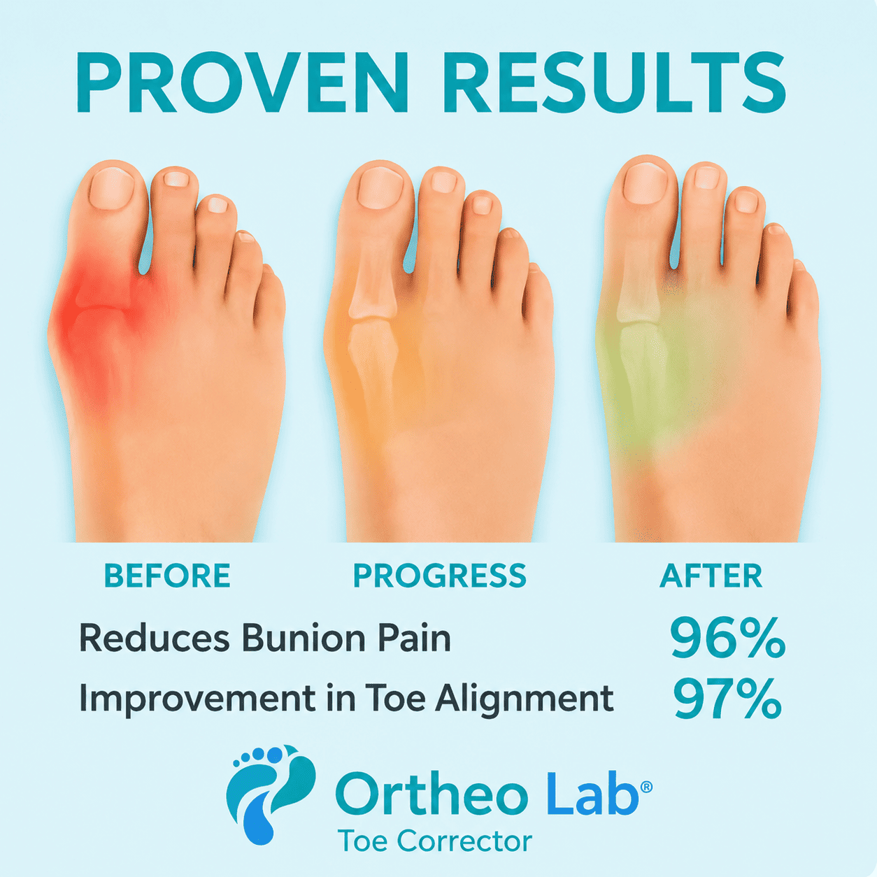 ORTHEO LAB®- BUNION FIX