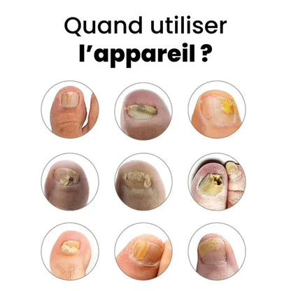 Appareil OrtheoLab